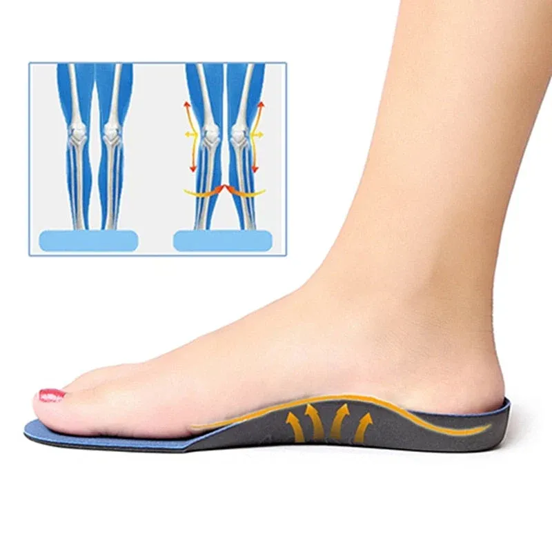 Comfy Flat Foot Corrector Shoe Pad - Image 0